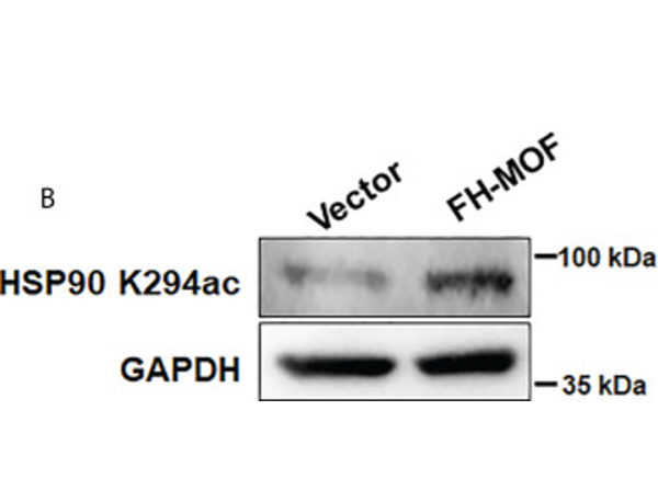 Western Blot using HSP90 K294ac